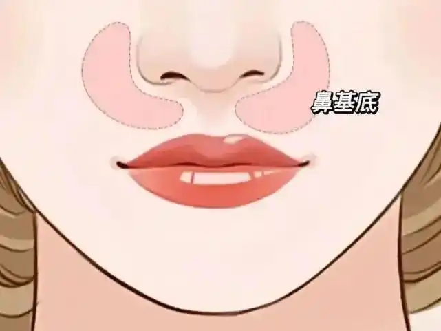 鼻尖整形术安全吗(做鼻尖整形容易留疤吗)