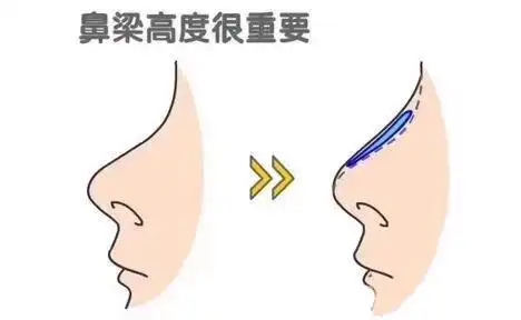 做完鼻综合手术头晕恶心正常吗(鼻部综合整形的效果)