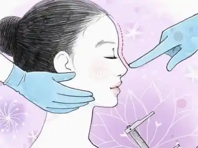 做完鼻综合手术头晕恶心正常吗(鼻综合手术需要多长时间)