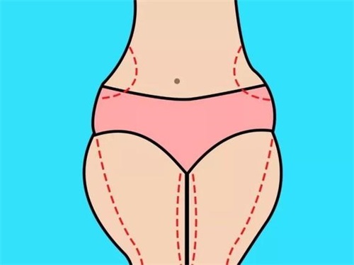 大腿吸脂会在大腿上留疤吗(大腿吸脂后多久能恢复)