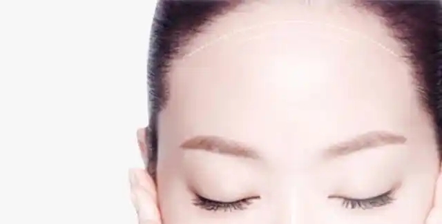为什么需要丰额头(珠海丰额头适合人群有哪些)