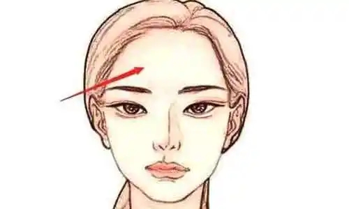 自体脂肪丰额头的术后护理(怎样进行额头整形呢)
