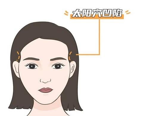 自体脂肪丰太阳穴需要二次注射吗(珠海自体脂肪丰太阳穴后应怎么护理)