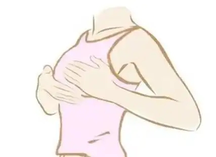 巨乳缩小手术会反弹吗(巨乳缩小的假体形状可以任意选择吗)