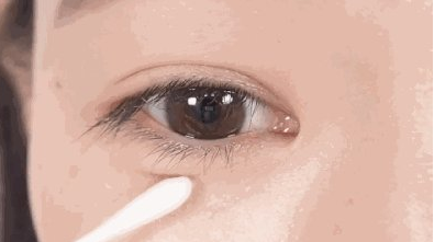 开内眼角效果好在哪里(哪些人适合开内眼角)