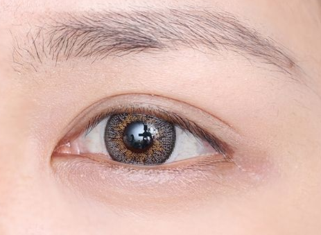 开外眼角有什么好处(开内眼角后如何快速消除疤痕)