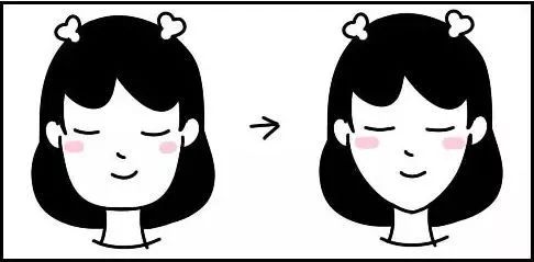 面部吸脂安全吗(面部吸脂瘦脸反弹吗)