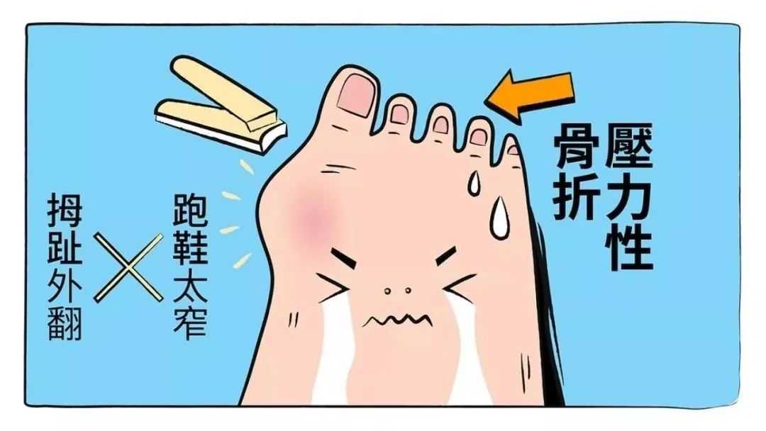 大脚骨矫正不会留下疤痕(症状严重的大脚骨要怎么治疗)