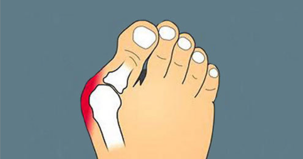 成都大脚骨矫正手术设备(大脚骨矫正不会留下疤痕) 成都大脚骨矫正手术设备(大脚骨矫正不会留下疤痕)