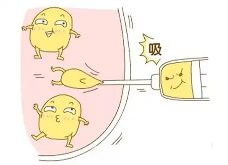 做全身吸脂的费用贵不贵(全身吸脂术后恢复期是多久)