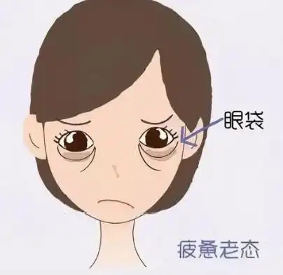 超声波祛眼袋术前注意事项(激光去眼袋需多久恢复)
