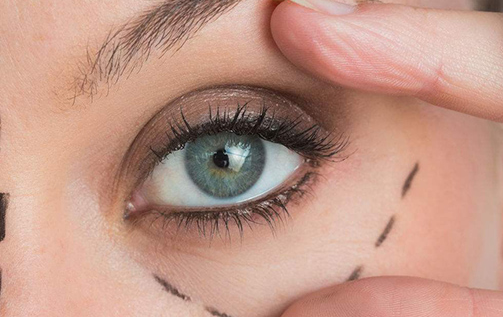 眼袋脂肪释放不需要去除脂肪(内切去眼袋多久恢复)