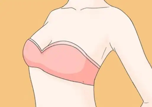 乳头凹陷矫正术的效果变化很理想吗(乳头内陷矫正手术会有副作用吗)