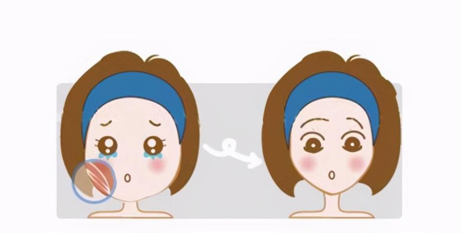 咬肌切除危险吗(福州去咬肌瘦脸会留疤痕吗)