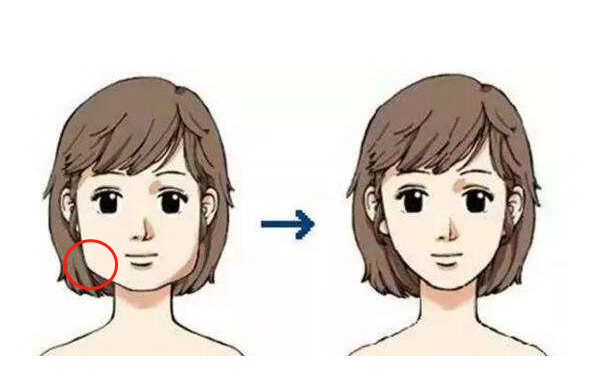 咬肌切除瘦脸的价格如何(去咬肌瘦脸原理是什么)