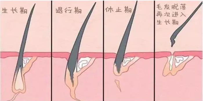 头发加密需开刀吗(移植的头发可以保持多久) 头发加密需开刀吗(移植的头发可以保持多久)