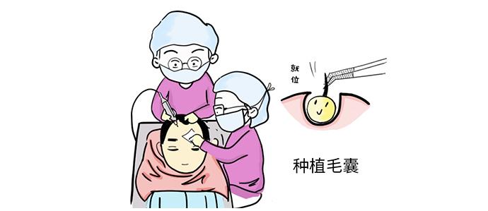 如何确保头顶加密的手术效果(鬓角种植多久见效)
