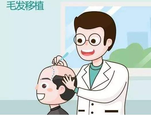 植发后应该如何安全度过脱发期(头发加密的效果)
