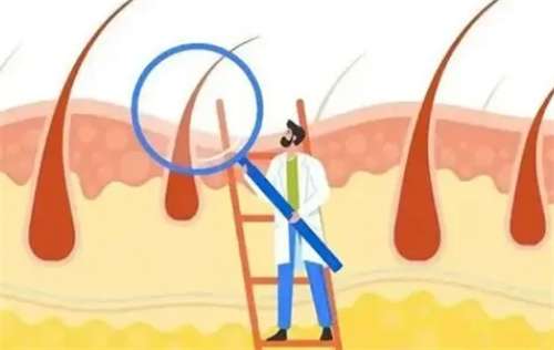 遗传性脱发能植发吗(头顶加密一般需要多少单位)