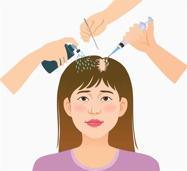 鬓角种植多久见效(如何确定需要种植多少单位的毛囊) 鬓角种植多久见效(如何确定需要种植多少单位的毛囊)