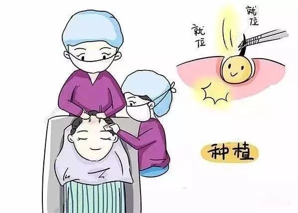 秃顶能植发吗(头发种植效果能持续多久)