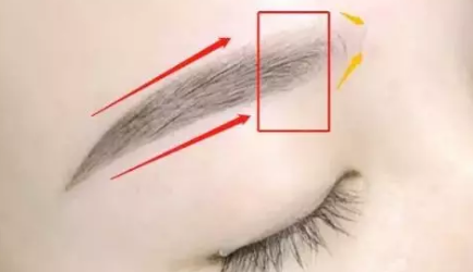 天津做提眉术要恢复多久(提眉手术50天可以往眼角打玻尿酸吗)