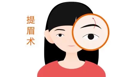 提眉手术是什么(做完提眉手术会不会留下明显的疤痕)