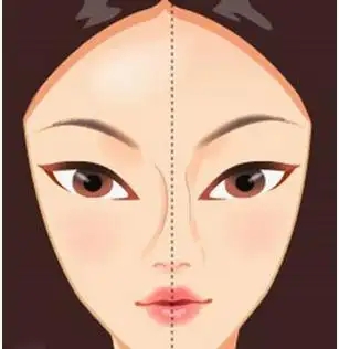 珠海歪鼻子的矫正方法有哪些(歪鼻矫正要住院吗)