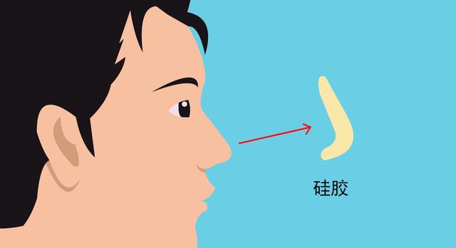 珠海做歪鼻矫正是怎么做的(珠海歪鼻矫正手术的副作用是什么)