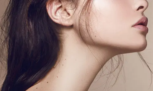 玻尿酸隆下巴的护理事项(做玻尿酸隆下巴有一些潜在的风险吗)
