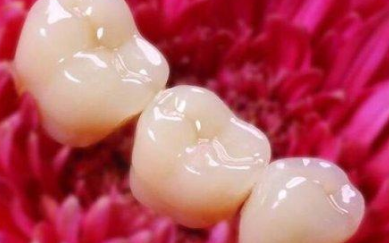 种植牙需要长期维护(种植牙的过程) 种植牙需要长期维护(种植牙的过程)